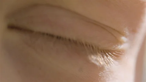 A child blinks close up. Baby's eye close up. A teen myopia. A bad child vision Stock Footage 108985410