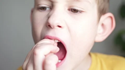 The child boy is shaking the front incisor tooth with his fingers Stock Footage 277877024