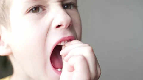 The child boy is shaking the front incisor tooth with his fingers Stock Footage 277877055