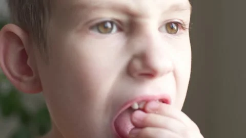 The child boy is shaking the front incisor tooth with his fingers Stock Footage 277877073