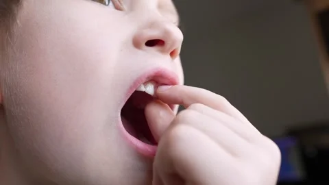 The child boy is shaking the front incisor tooth with his fingers Stock Footage 279239791
