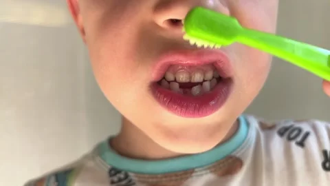 Child brushes with an up and down motion, missing front tooth, plaque Stock Footage 346153479