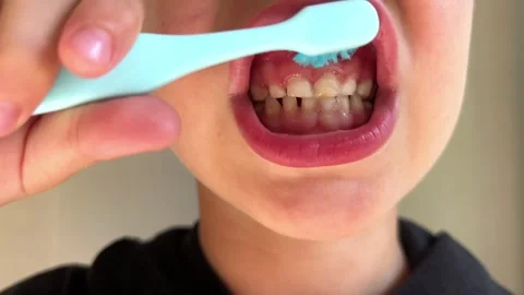 Child brushes front teeth with an up and down motion, visible enamel changes Stock Footage 346153464
