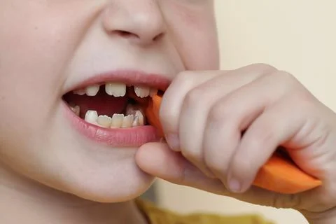 Child with crooked teeth. child eats carrots. close-up Stock Photos