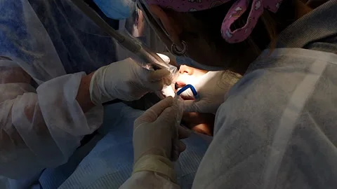 Child at dentist during surgery Stock Footage 134055355