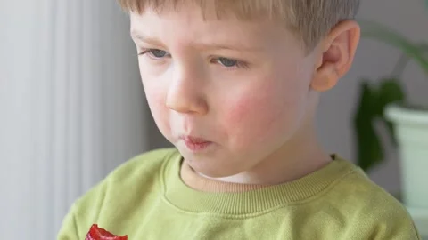 Child eating strawberry with red cheeks showing possible food allergy reaction Stock-Footage 330973244