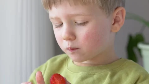 Child eating strawberry with red cheeks showing possible food allergy reaction Video stock 330973310