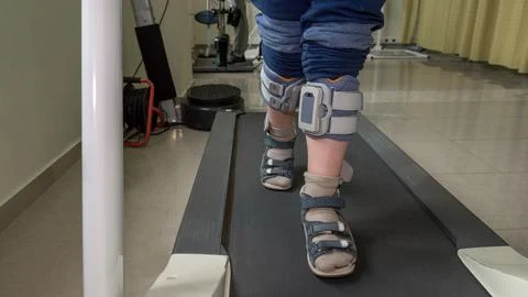 Child with foot drop system walking on the treadmill Stock Photos