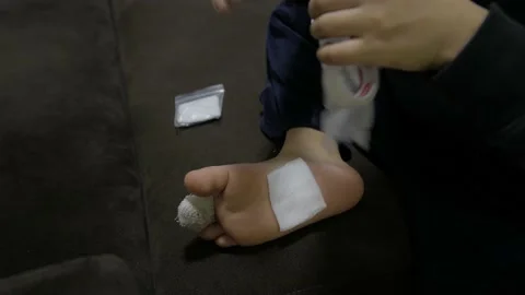 A child with a foot injury doing the first aid. Stock-Footage 155367564