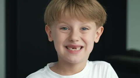 The child has lost two milk teeth. Replacement of permanent replacement teeth Stock Footage 284877333