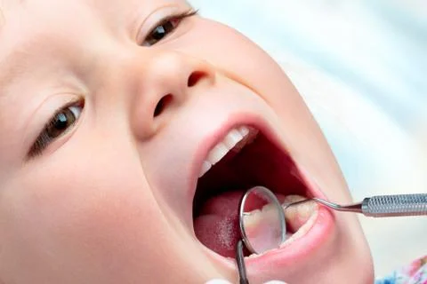Child having dental examination. Foto stock