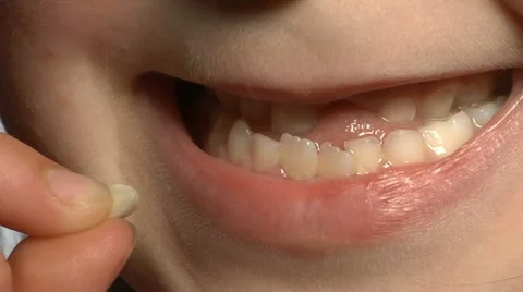 Child loses a tooth Stock Footage 22664055
