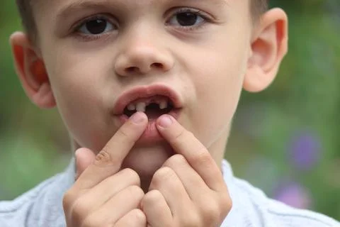 The child lost a tooth. Selective focus.Concept baby tooth Stock Photos