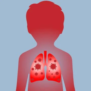Child lungs with coronavirus Stock Illustration