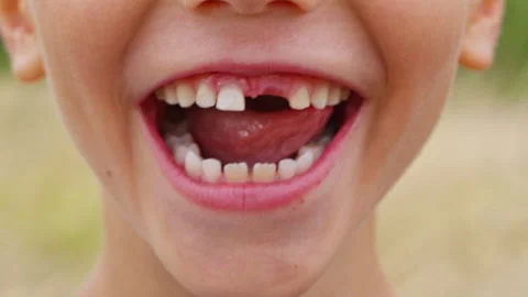 Child Missing Tooth Close-Up - Parenting &amp; Dental Health Content Stock Footage 255860021