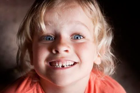 Child with missing tooth Stock Photos