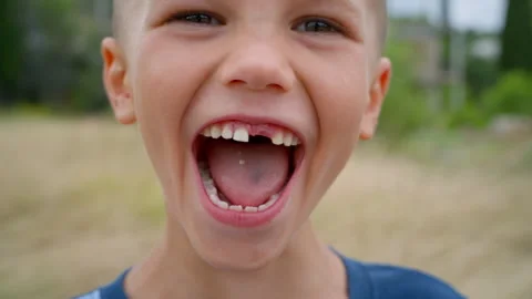Child Missing Tooth Smile - Dental Ads &amp; Parenting Content Stock Footage 248514491