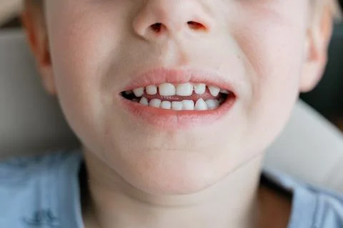 Child with Mixed Teeth Smiling Casually Foto stock