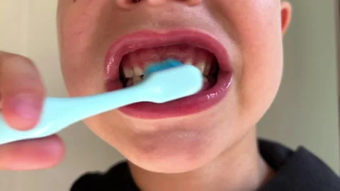 Child with primary teeth brushes front teeth from side to side, enamel changes Stock Footage 346153443