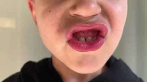 Child with primary teeth puffs lips and huffs, enamel changes, expressing anger Stock Footage 346153364