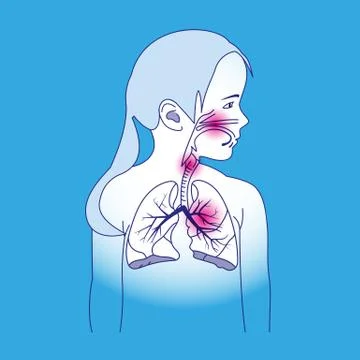 Child Respiratory Scheme Stock-Illustration