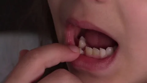 Child showing milk tooth which is about to fall out Stock Footage 72632391