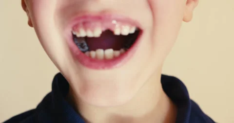 Child showing a missing front baby tooth Stock-Footage 346983035