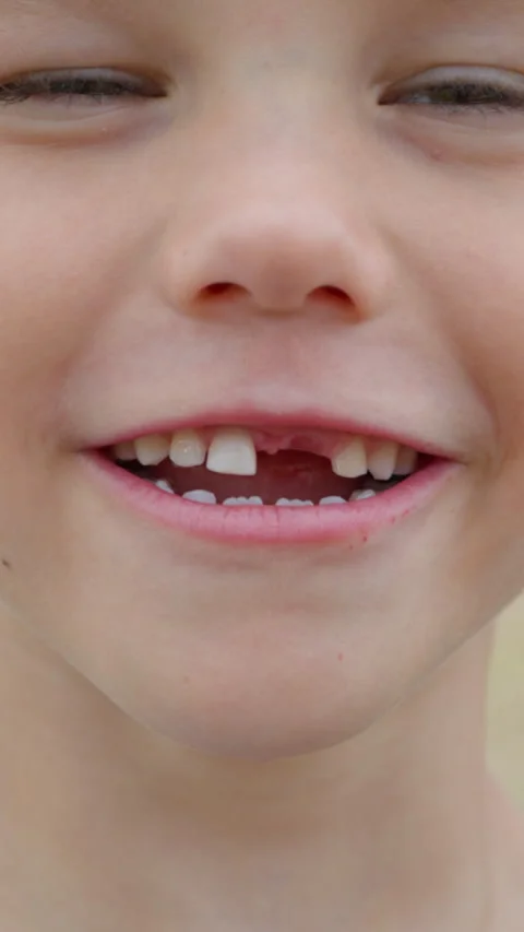 Child smiling with missing front milk teeth. Video stock 328479739