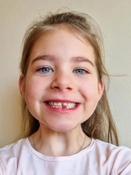 Child Smiling with a Missing Tooth Stock Photos