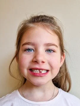Child Smiling with a Missing Tooth Stock Photos