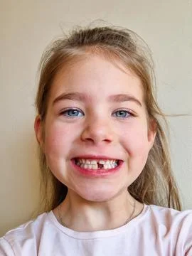 Child Smiling with a Missing Tooth Stock Photos