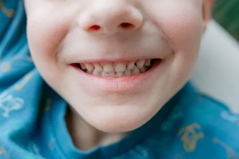 Child smiling teeth closeup Фото
