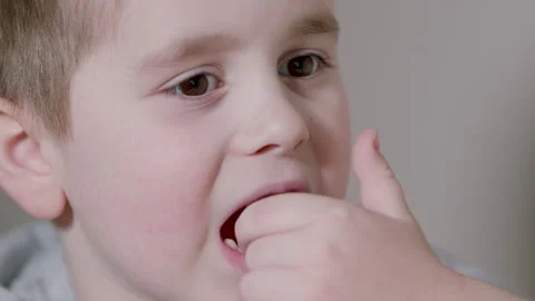 Child Wiggling His Front Milk Teeth. Child Showing His Milk Tooth Before Losing Stock Footage 304105115