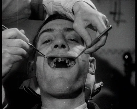 Children's teeth, dentist showing decayed and substitute false teeth, UK 1945 Vidéo 146086931