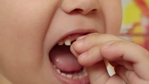 Childs hands pull out a wobbly milk tooth from the gumline Stock Footage 318359376