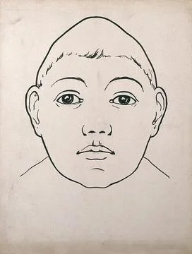 Child's head with large temporal lobes and depressed frontal lobe. Drawing,.. Stock Illustration