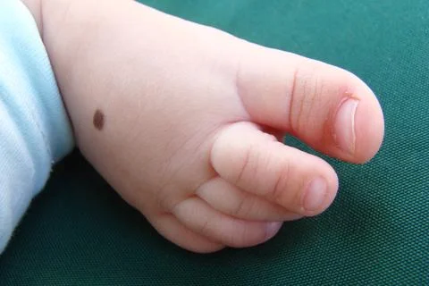 Child's leg Stock Photos