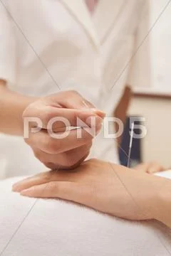 Chinese Doctor Using Acupuncture On Patient