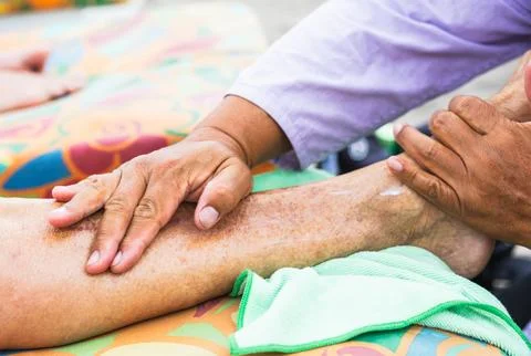 Chinese massage techniques applied on elderly woman's leg Stock Photos