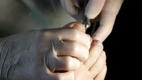 Chiropodist big toe nail Stock Footage 247471837