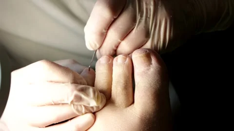 Chiropodist clearing cuticles Stock Footage 247471844