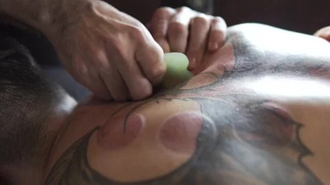 Chiropractic Back Stock Footage 246790895