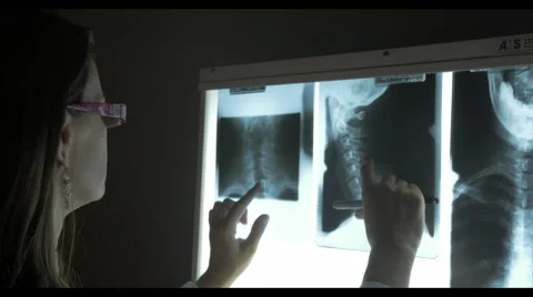 Chiropractor Examines X-Ray Stock Footage 40296669