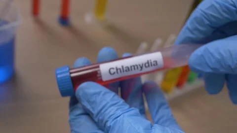 Chlamydia Test Tube Being Hold By Scientist Closeup Stock Footage 77104151