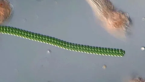 Chlorella algae and rotifer under microscopy view Vídeos de archivo 306578048