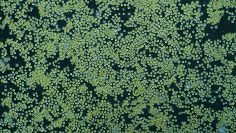 Chlorella algae cells under microscope dark-field 100x magnification Stock Footage 346431599