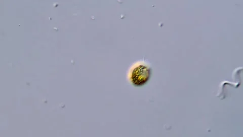 Chlorophyta Microscopic Organisms in Water Sample Stock-Footage 317787357