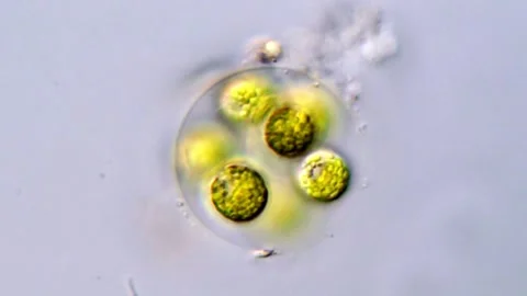Chlorophyta Microscopic Organisms in Water Sample, 400x Stock-Footage 317885730