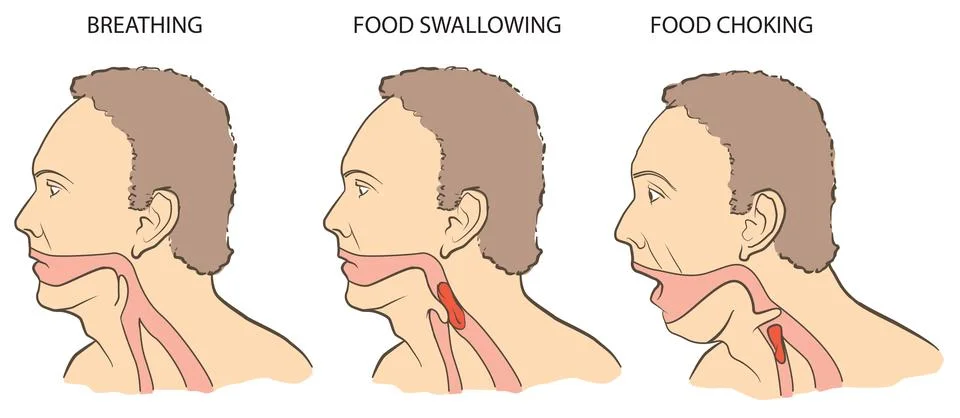 Choking Stock Illustration