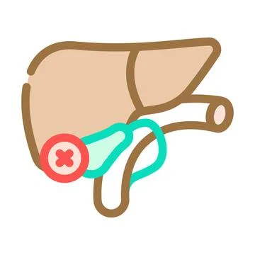 Cholecystectomy surgery color icon vector illustration Stock Illustration